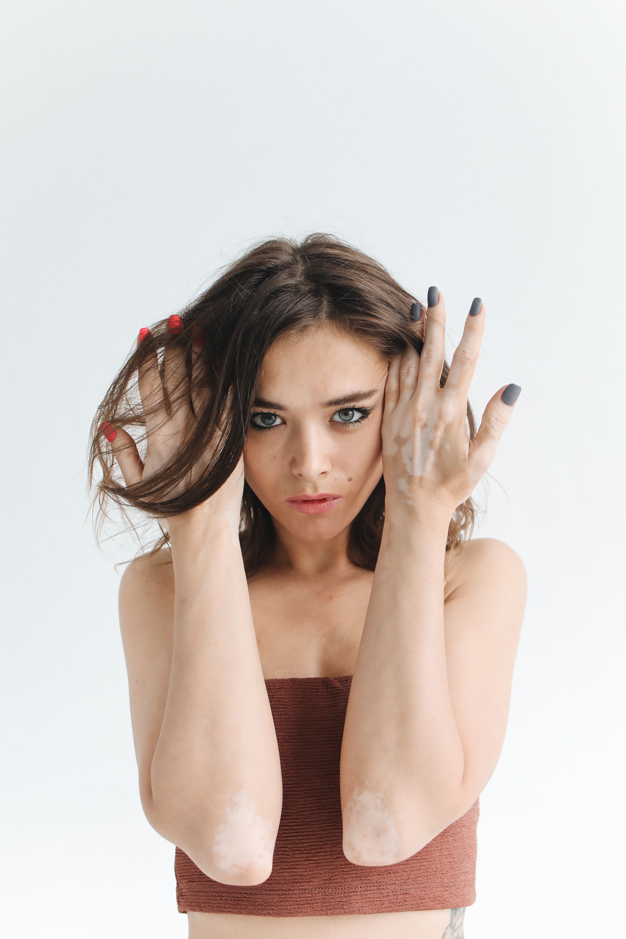 Skin Conditions and Self-Confidence: Coping With Visible Changes cover