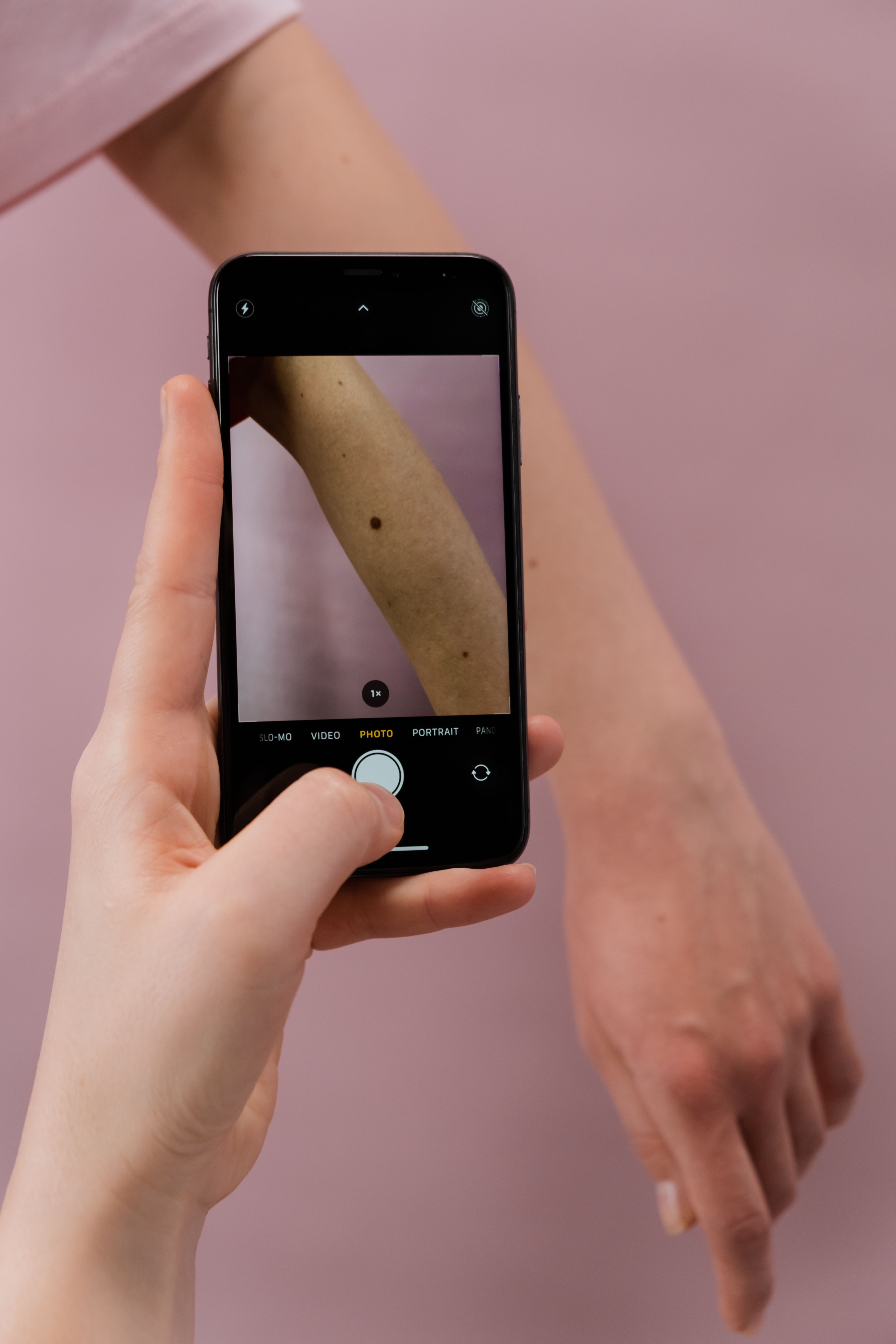 Why Tracking Your Skin Symptoms Can Improve Conversations With Your Dermatologist cover